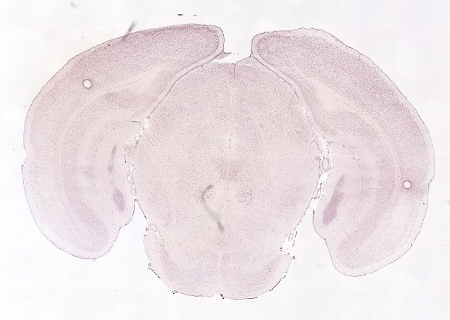 Allen ISH experiment 72109410, image 71997799 -- target region: CP (Caudoputamen)