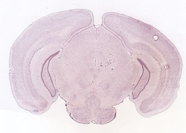 Allen ISH experiment 72109410, image 71997803 -- target region: CP (Caudoputamen)