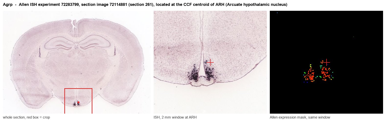 Agrp Allen ISH at the CCF centroid of ARH