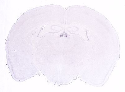 Allen ISH experiment 1472, image 101362041 -- target region: MH (Medial habenula)