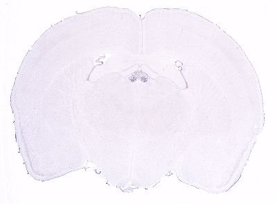 Allen ISH experiment 1472, image 101362047 -- target region: MH (Medial habenula)