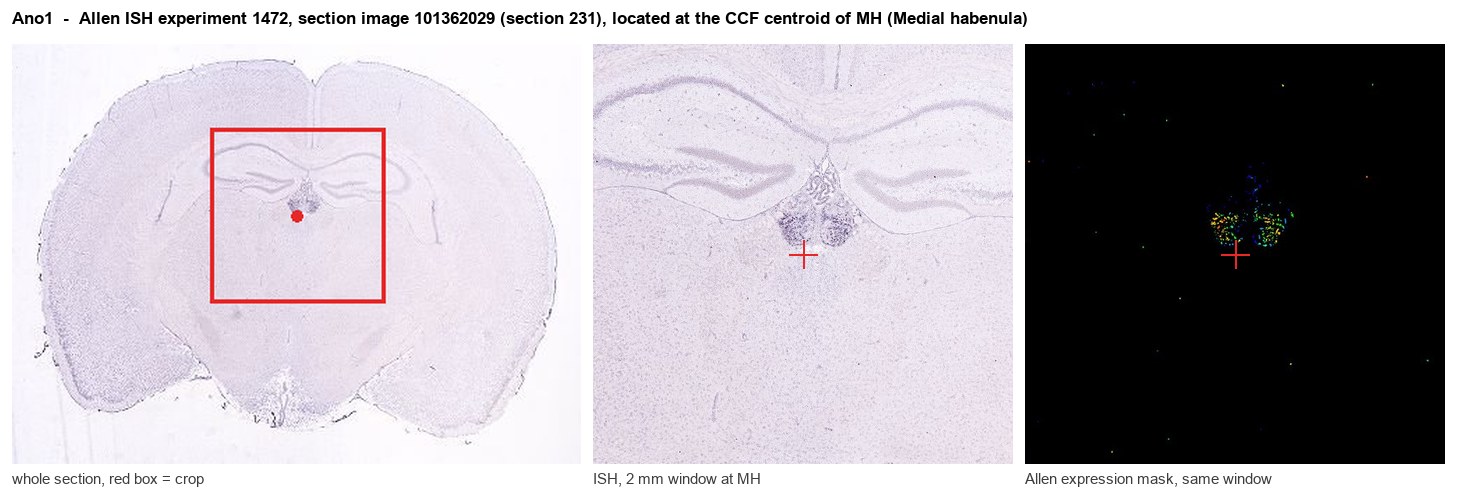 Ano1 Allen ISH at the CCF centroid of MH