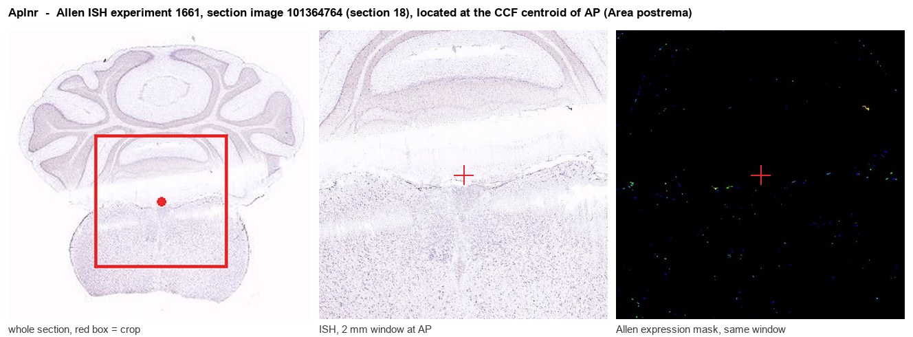 Aplnr Allen ISH at the CCF centroid of AP