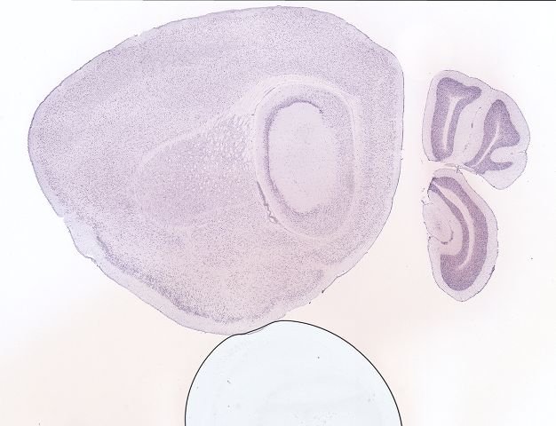 Allen ISH experiment 70227974, image 70062046 -- target region: LC (Locus ceruleus)