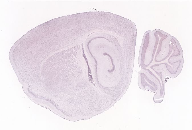 Allen ISH experiment 70227974, image 70062050 -- target region: LC (Locus ceruleus)