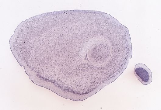 Allen ISH experiment 69014907, image 68825866 -- target region: RO (Nucleus raphe obscurus)