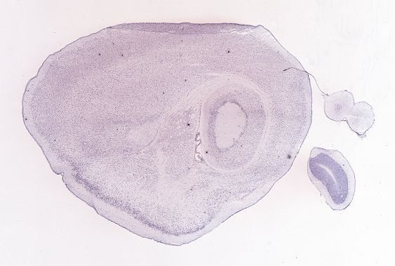Allen ISH experiment 69014907, image 68825868 -- target region: RO (Nucleus raphe obscurus)