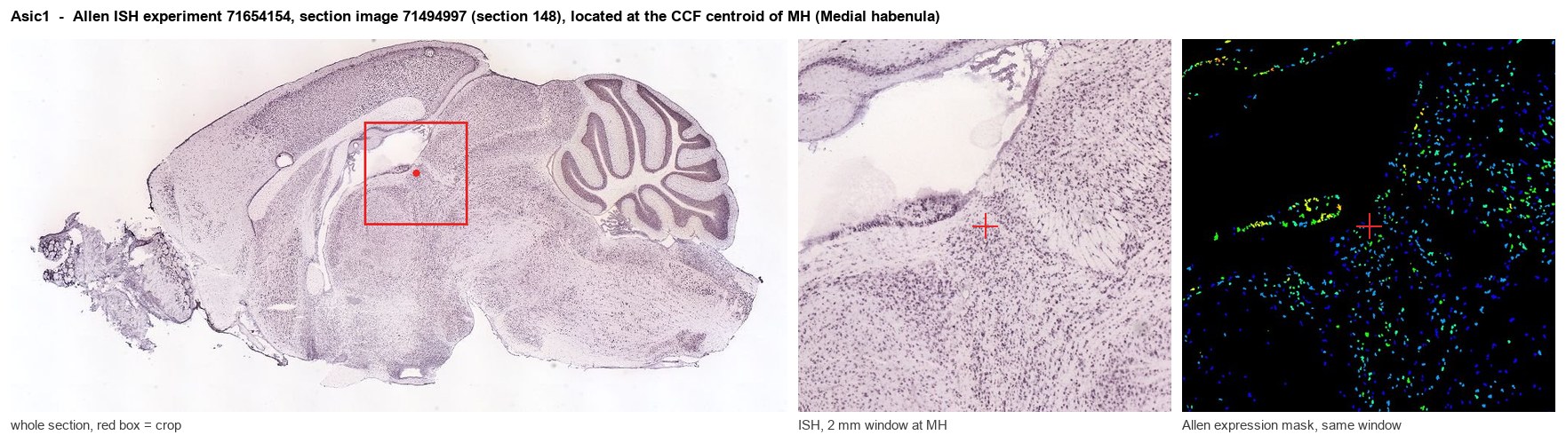 Asic1 Allen ISH at the CCF centroid of MH