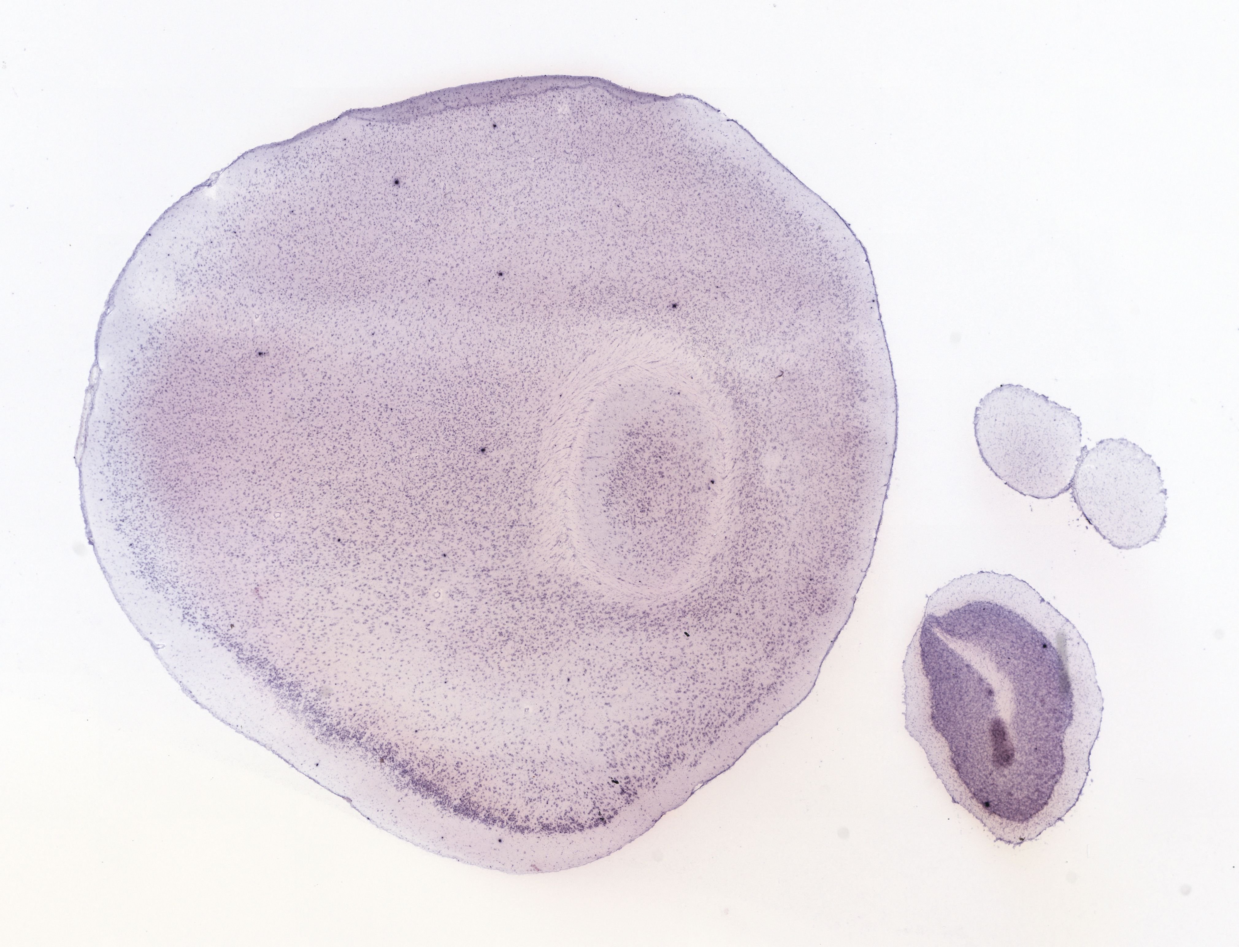 Allen ISH experiment 69013609, image 68812601 -- target region: ME (Median eminence)