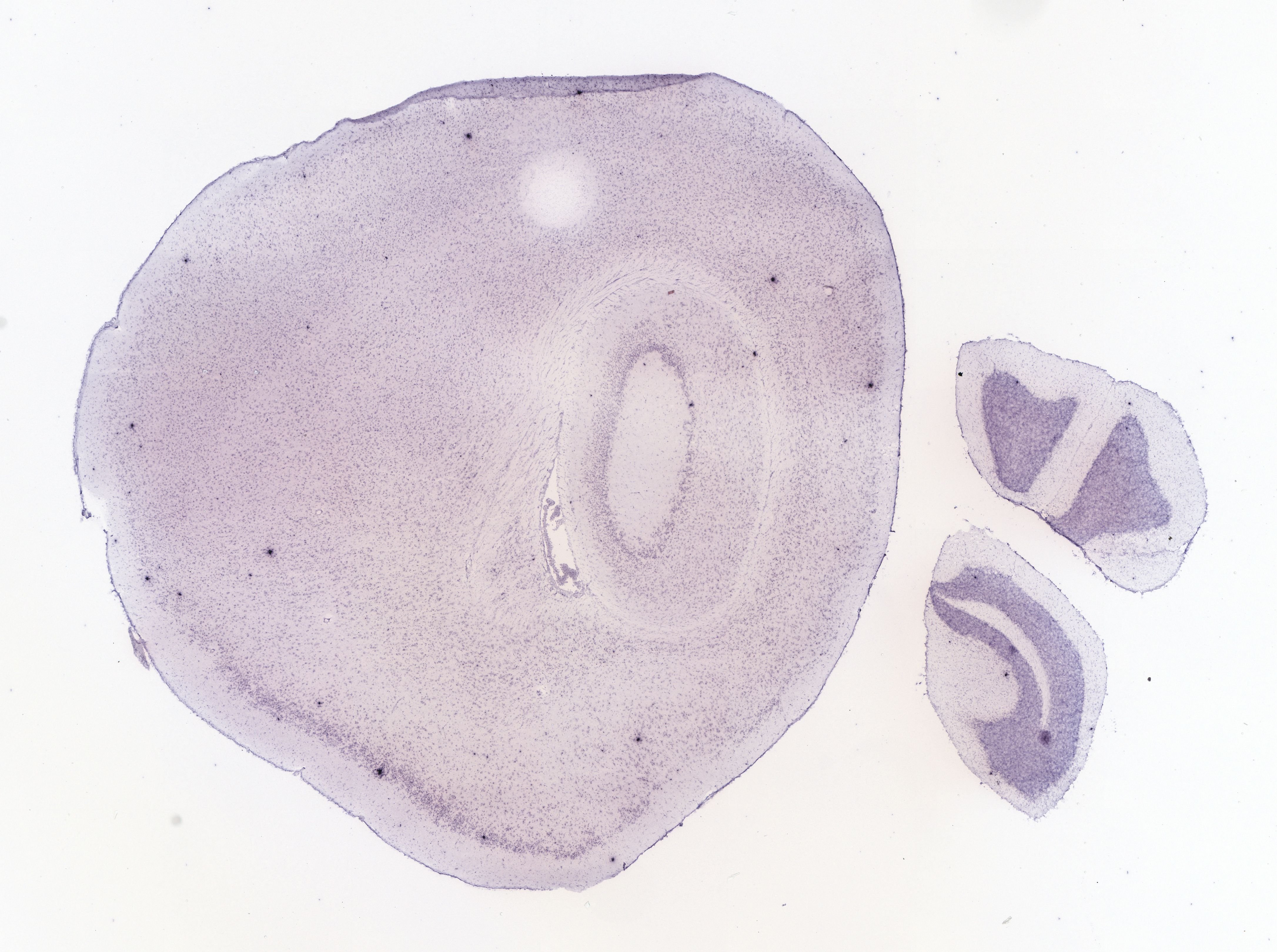 Allen ISH experiment 69013609, image 68812603 -- target region: ME (Median eminence)