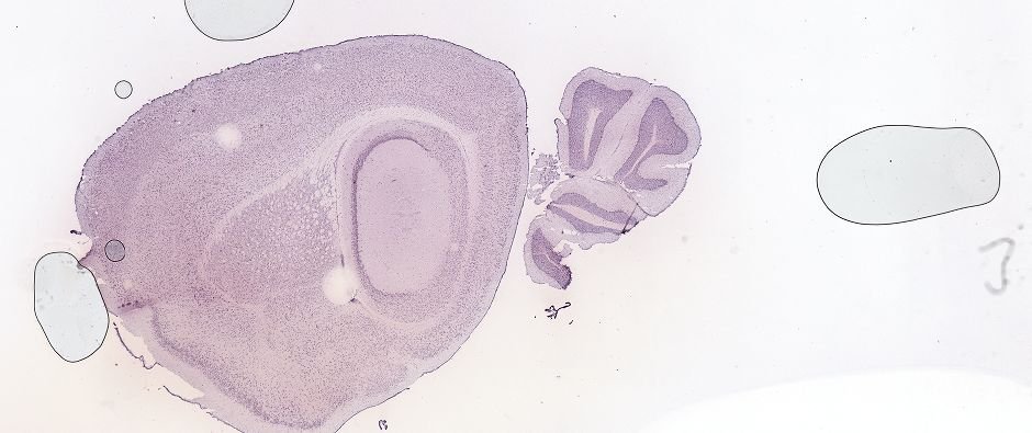 Allen ISH experiment 69236771, image 69084391 -- target region: DCO (Dorsal cochlear nucleus)