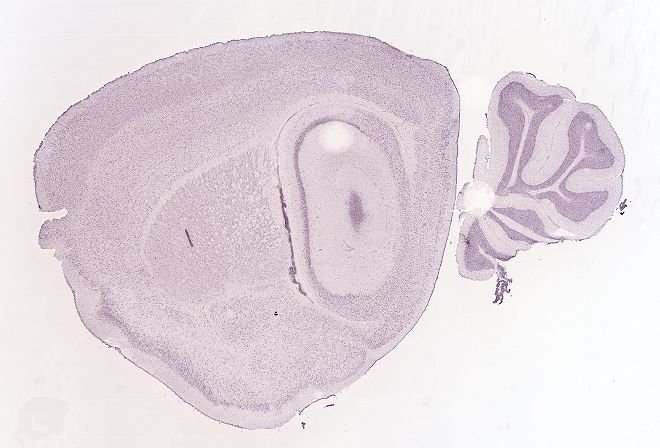 Allen ISH experiment 69236771, image 69084393 -- target region: DCO (Dorsal cochlear nucleus)