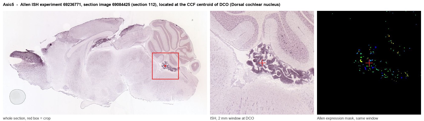 Asic5 Allen ISH at the CCF centroid of DCO