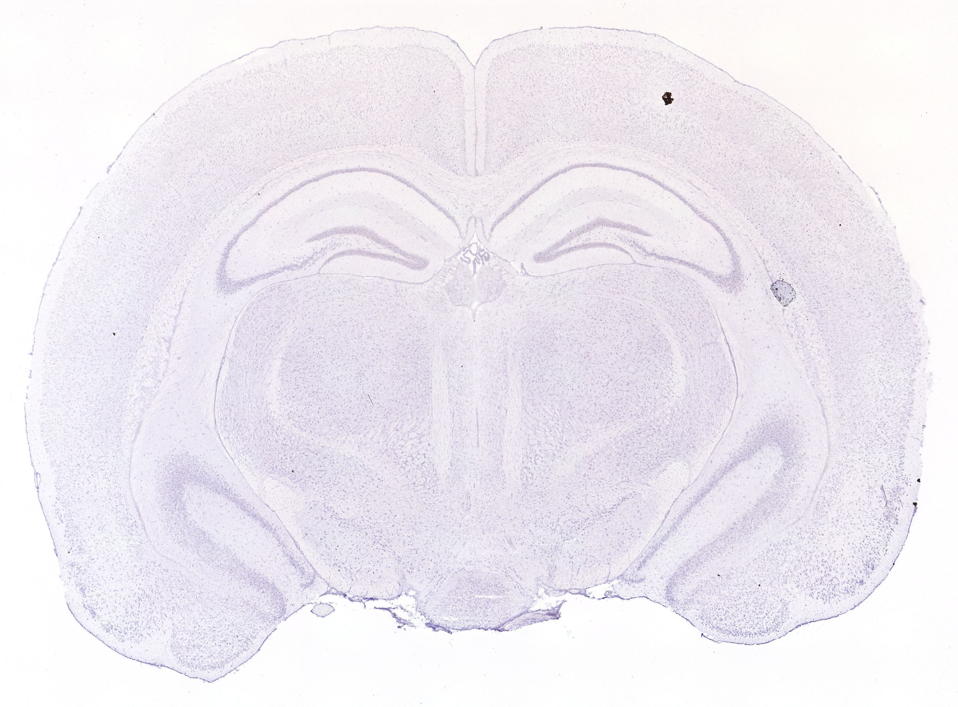 Allen ISH experiment 131, image 101327147 -- target region: SCH (Suprachiasmatic nucleus)