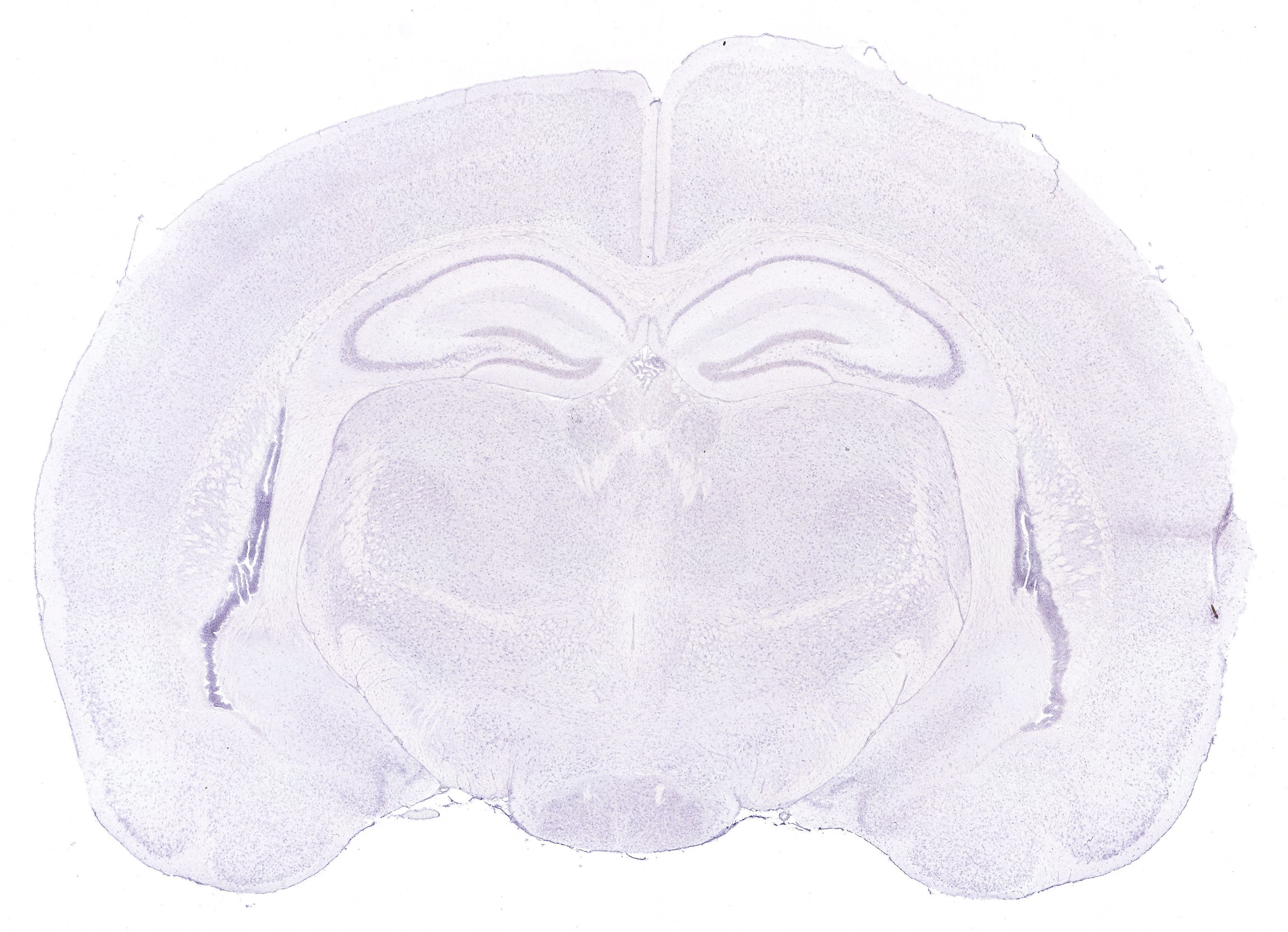 Allen ISH experiment 131, image 101327153 -- target region: SCH (Suprachiasmatic nucleus)