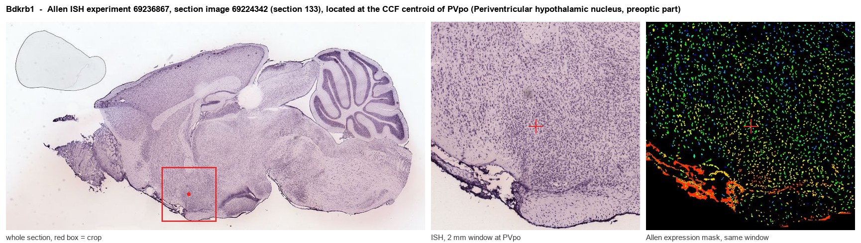 Bdkrb1 Allen ISH at the CCF centroid of PVpo
