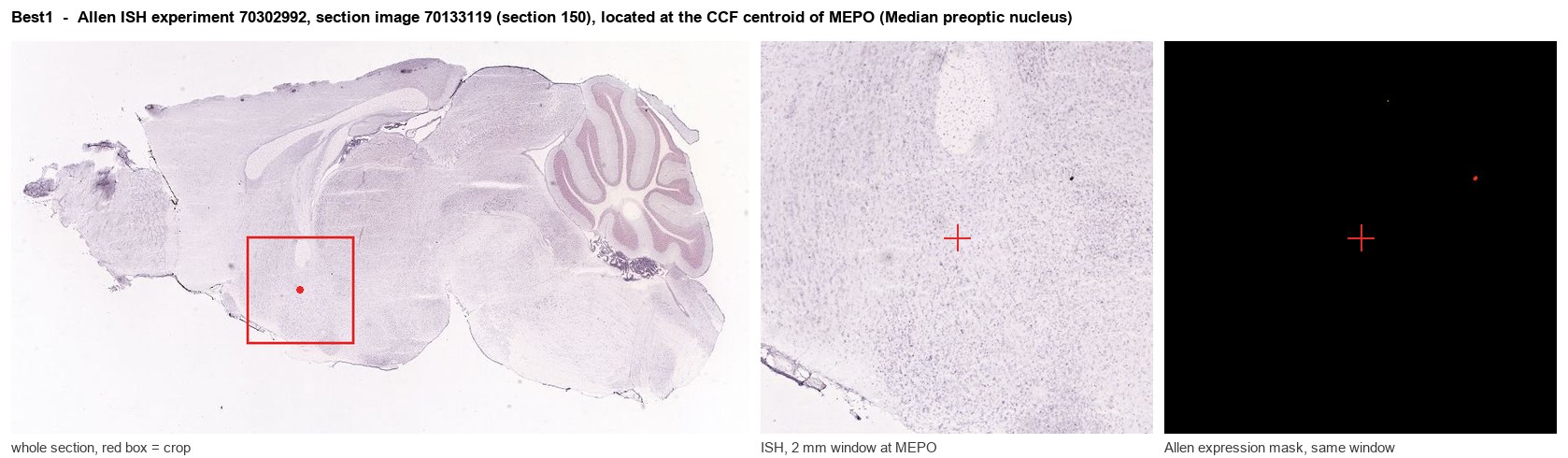 Best1 Allen ISH at the CCF centroid of MEPO