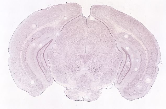 Allen ISH experiment 70560328, image 70368093 -- target region: PD (Posterodorsal preoptic nucleus)