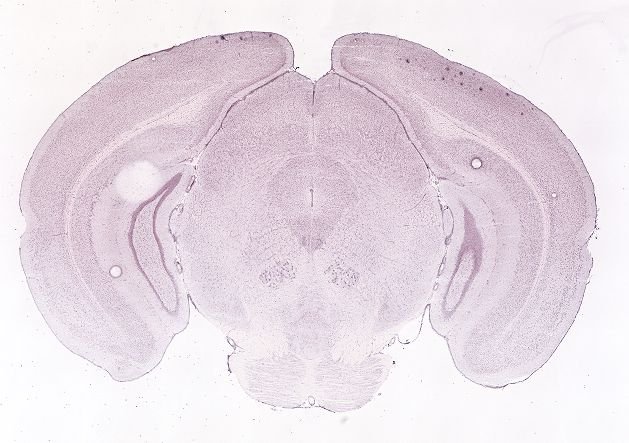 Allen ISH experiment 70560328, image 70368695 -- target region: PD (Posterodorsal preoptic nucleus)