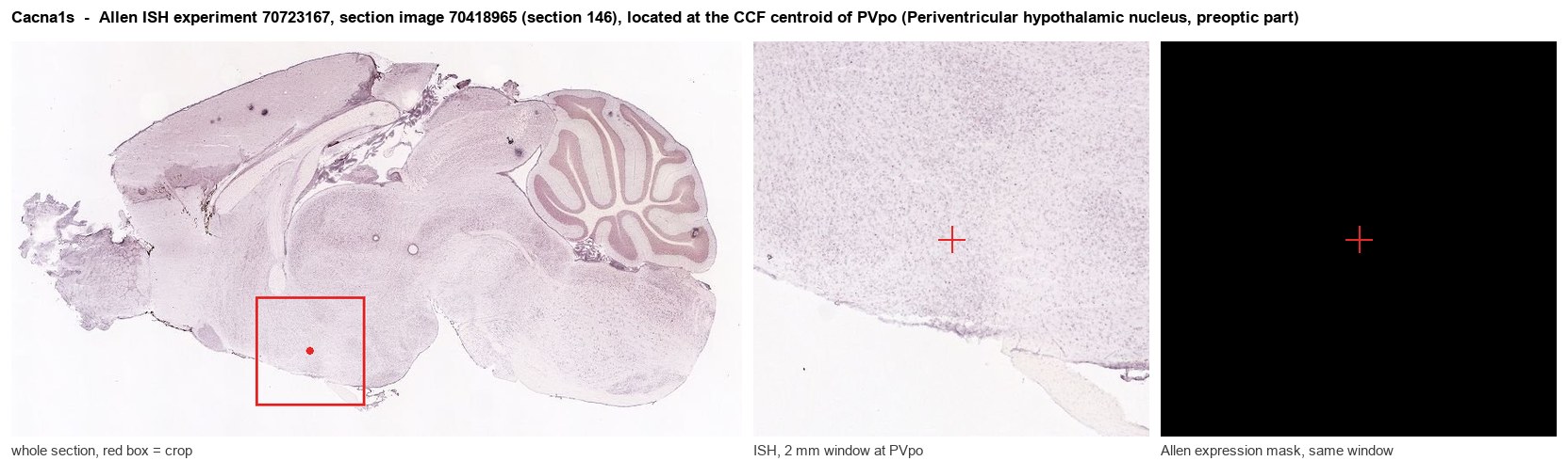 Cacna1s Allen ISH at the CCF centroid of PVpo