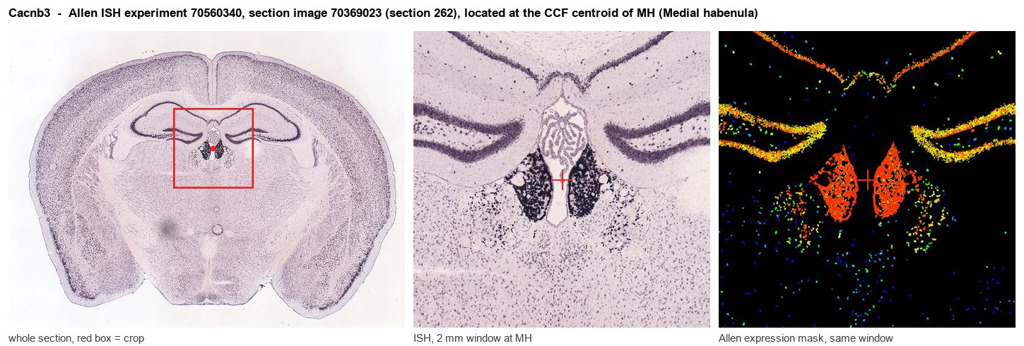 Cacnb3 Allen ISH at the CCF centroid of MH