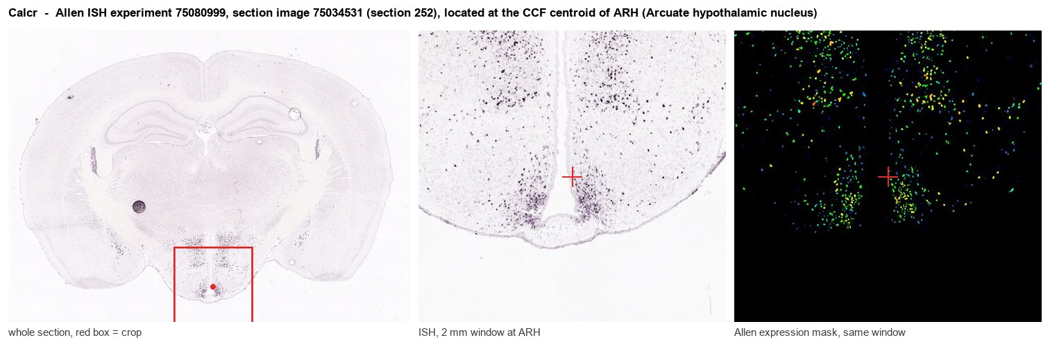 Calcr Allen ISH at the CCF centroid of ARH