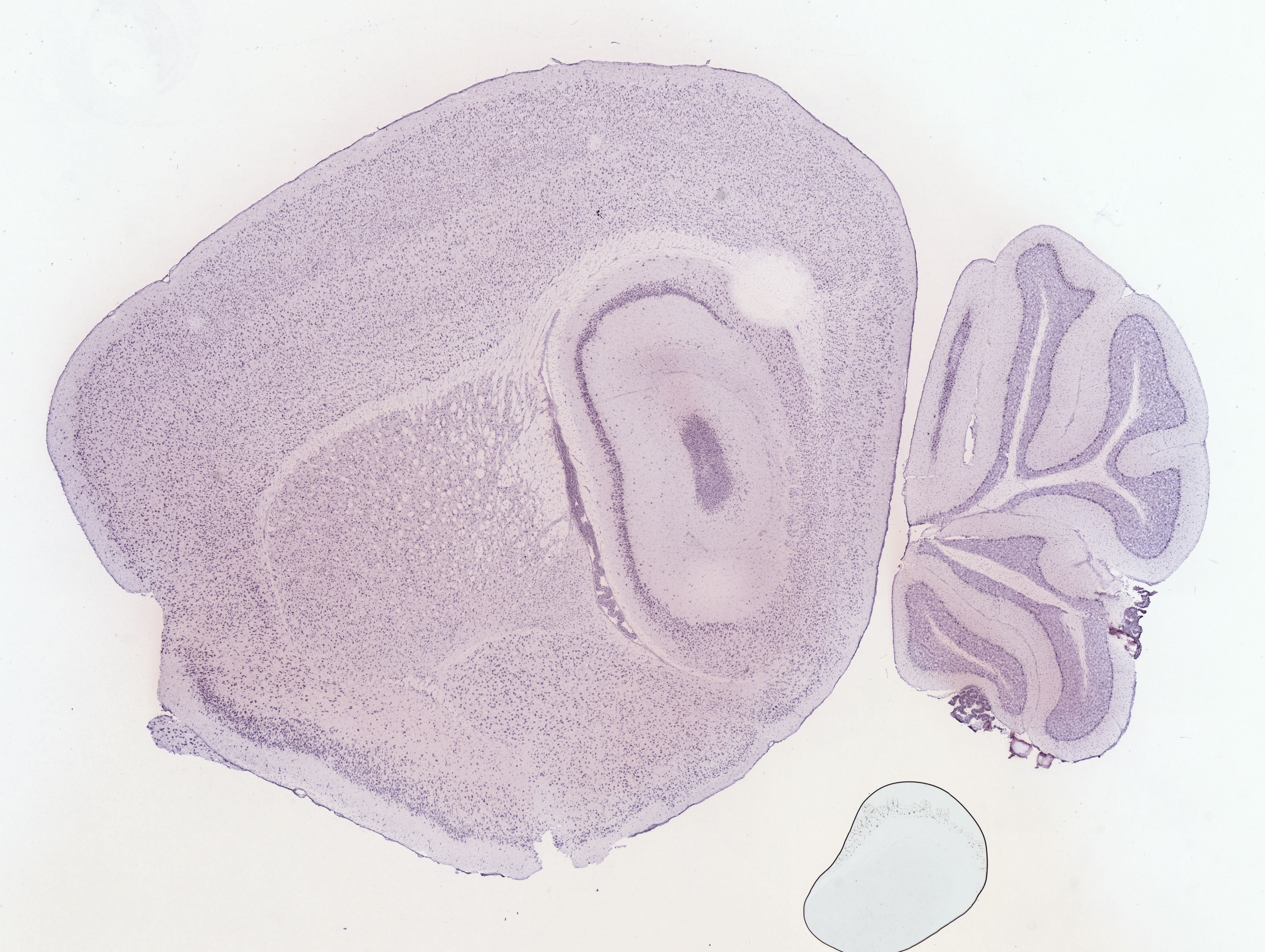 Allen ISH experiment 69236981, image 69226600 -- target region: DR (Dorsal nucleus raphe)