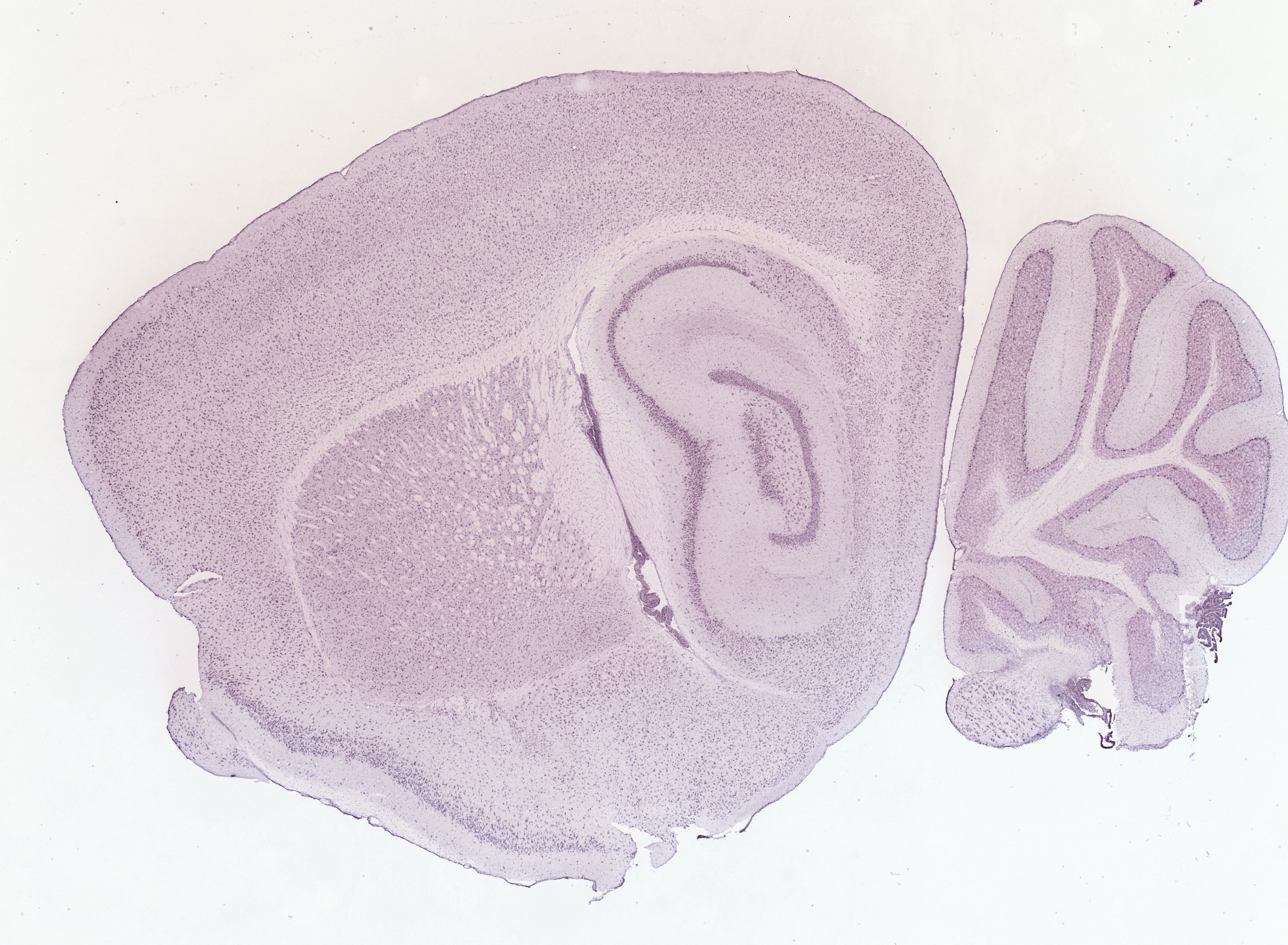 Allen ISH experiment 69236981, image 69226602 -- target region: DR (Dorsal nucleus raphe)