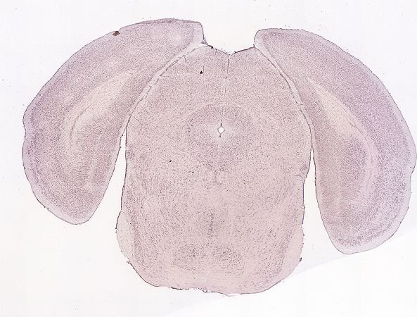 Allen ISH experiment 74724659, image 74648707 -- target region: OV (Vascular organ of the lamina terminalis)
