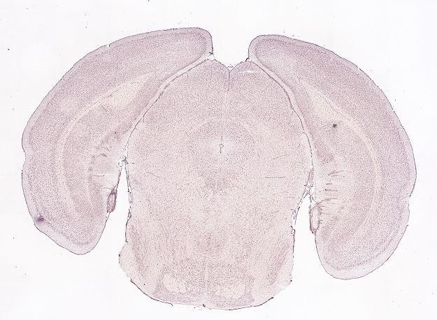 Allen ISH experiment 74724659, image 74648709 -- target region: OV (Vascular organ of the lamina terminalis)