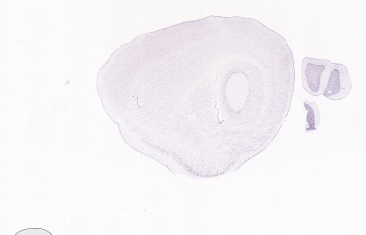 Allen ISH experiment 77793175, image 77792035 -- target region: CP (Caudoputamen)