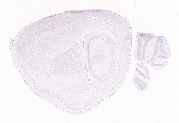 Allen ISH experiment 77793175, image 77792037 -- target region: CP (Caudoputamen)
