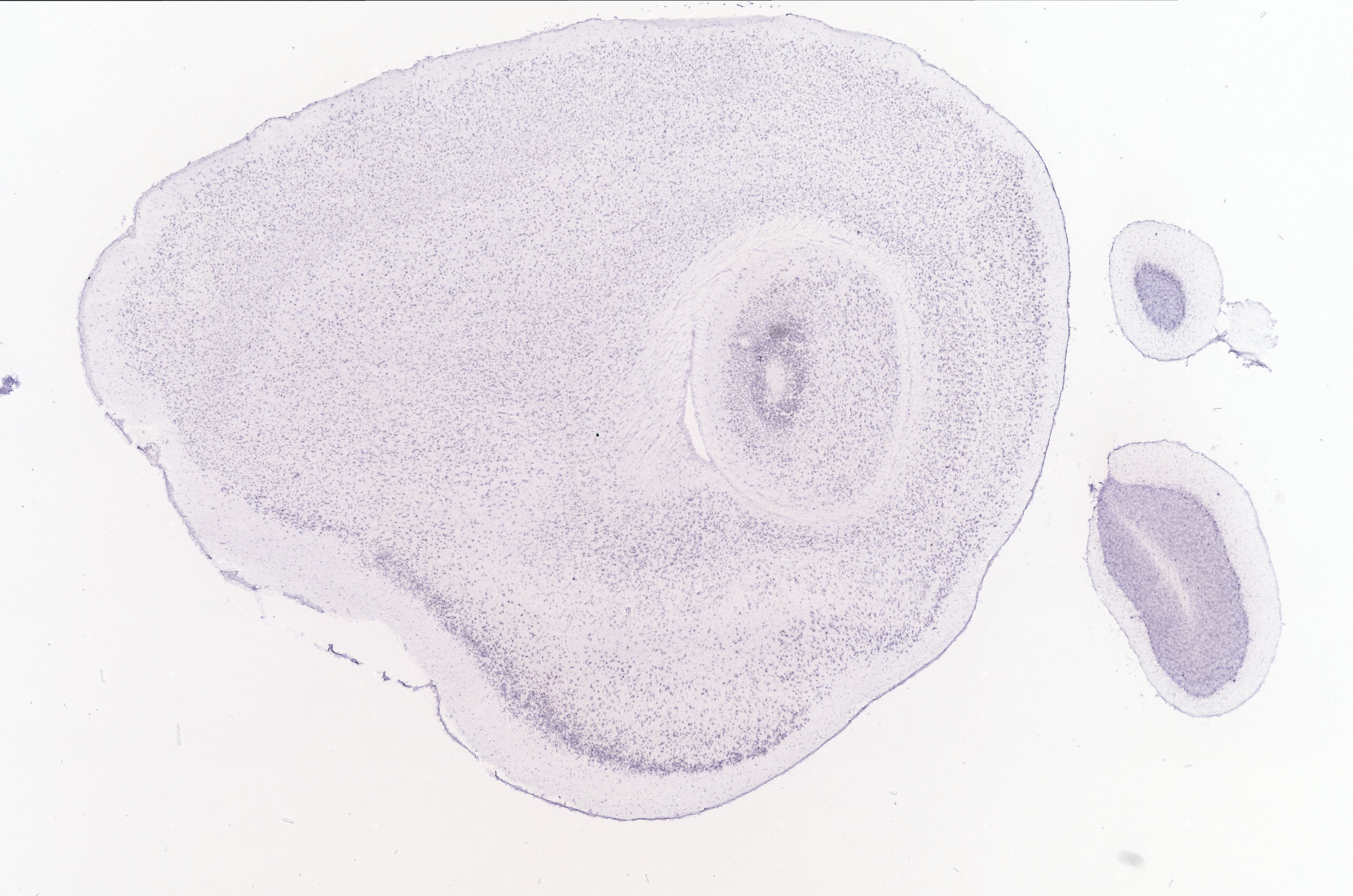 Allen ISH experiment 69548870, image 69524639 -- target region: MH (Medial habenula)