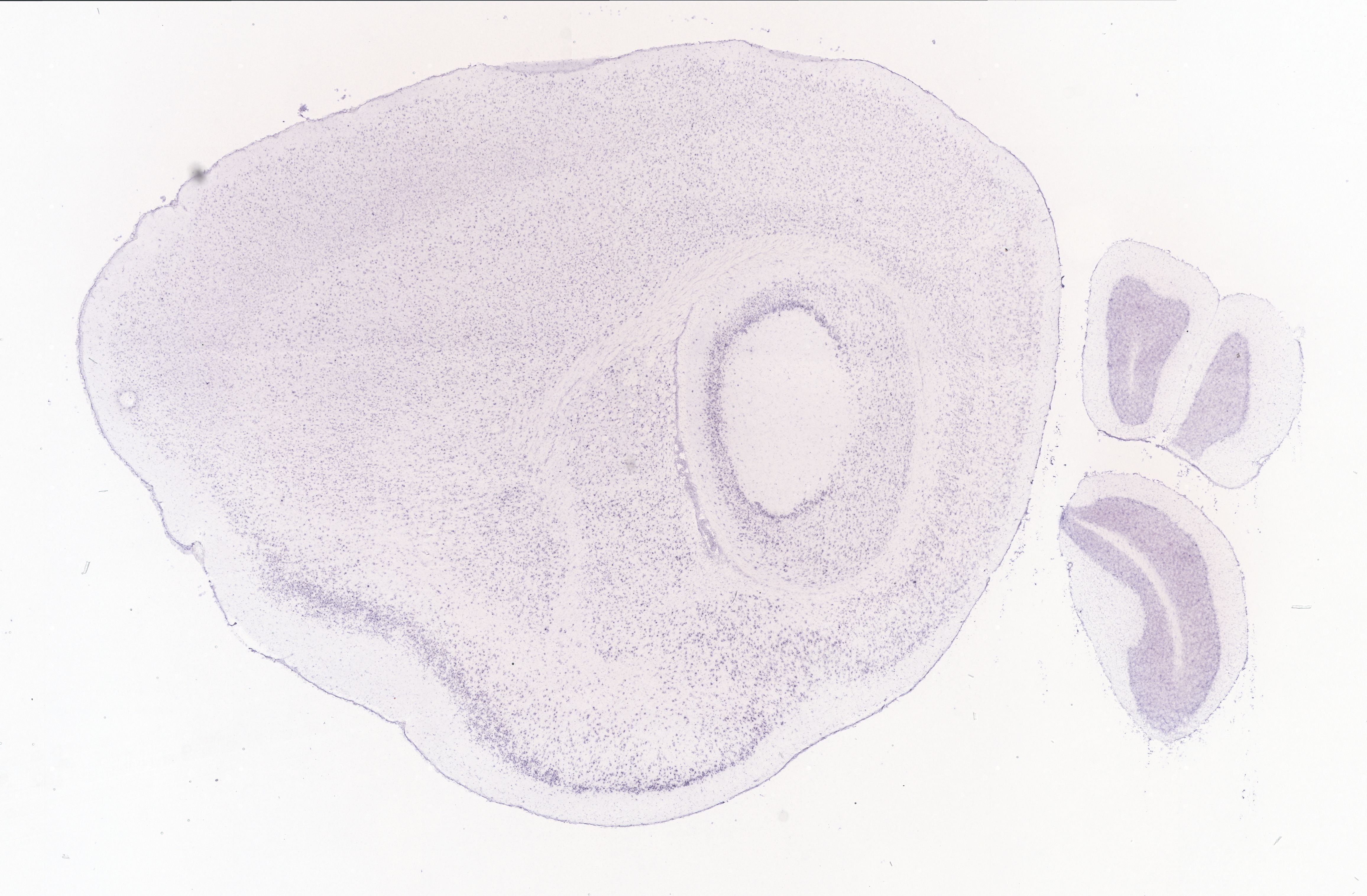 Allen ISH experiment 69548870, image 69524641 -- target region: MH (Medial habenula)