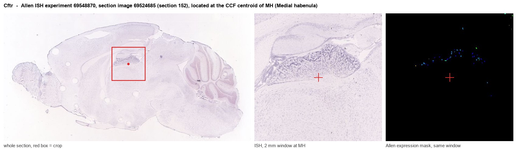 Cftr Allen ISH at the CCF centroid of MH