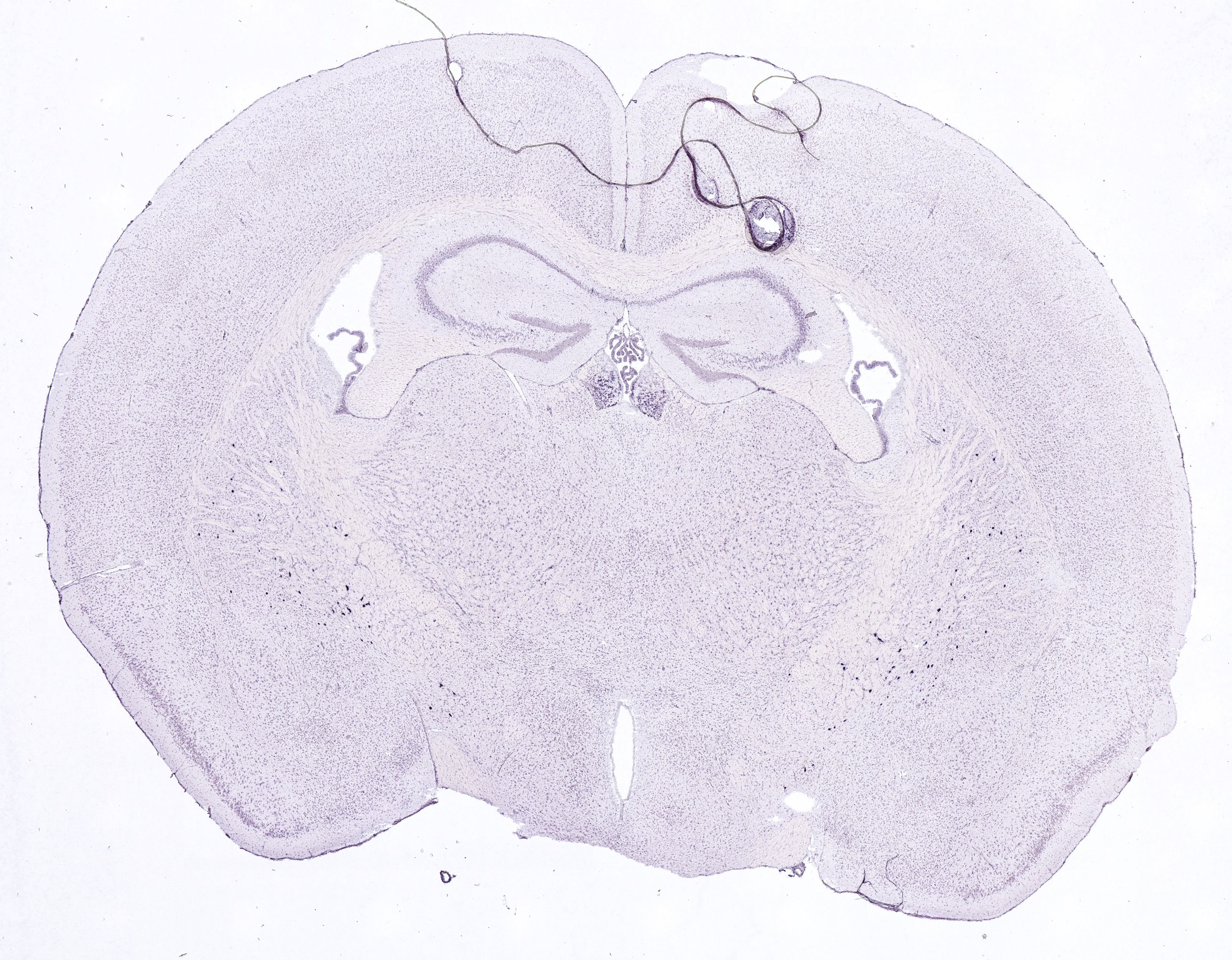 Allen ISH experiment 252, image 101320721 -- target region: MH (Medial habenula)