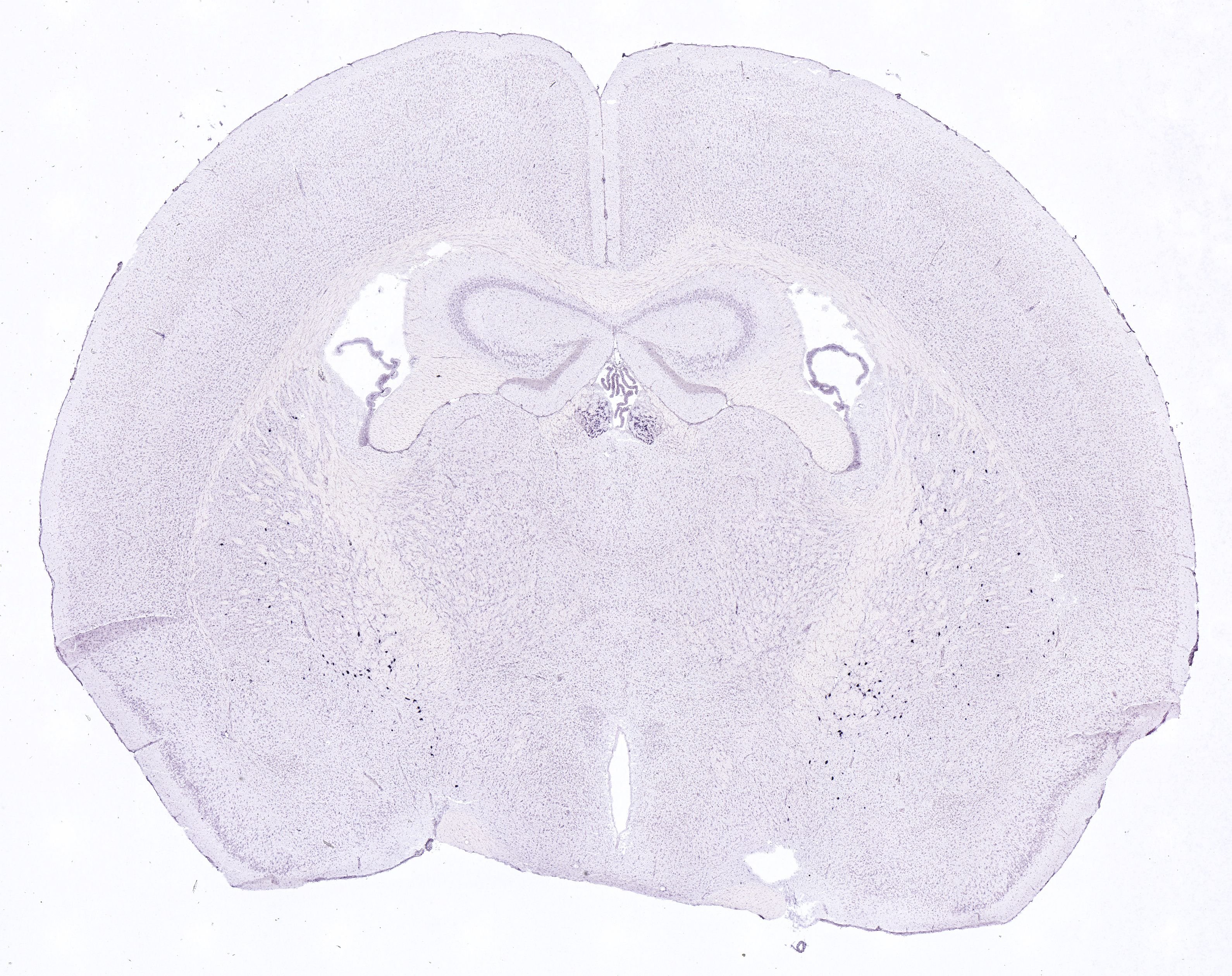Allen ISH experiment 252, image 101320722 -- target region: MH (Medial habenula)