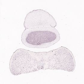 Allen ISH experiment 75551460, image 75488168 -- target region: IPR (Interpeduncular nucleus, rostral)