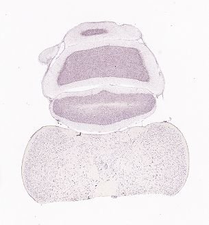 Allen ISH experiment 75551460, image 75488170 -- target region: IPR (Interpeduncular nucleus, rostral)