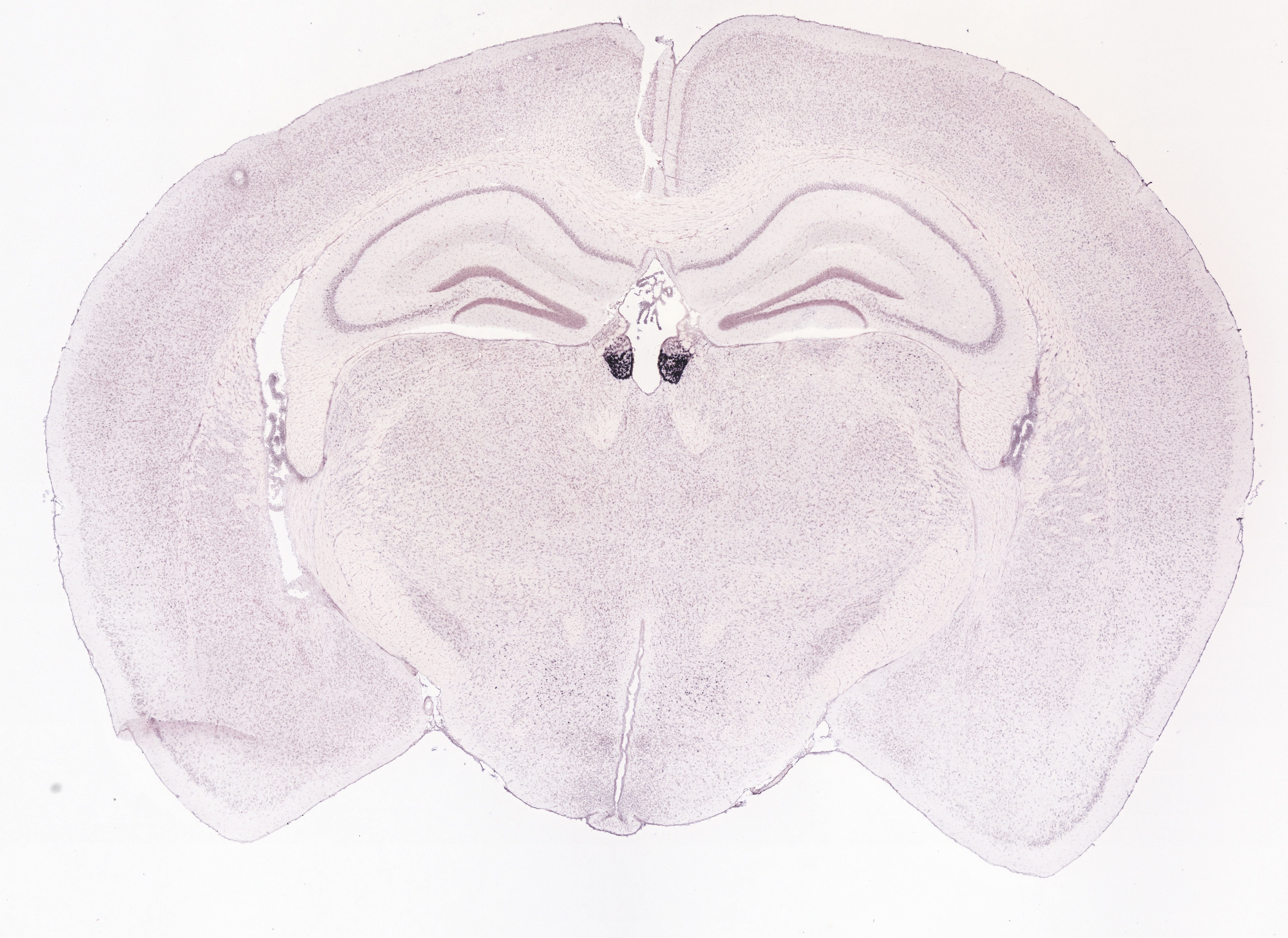 Allen ISH experiment 72119655, image 72040226 -- target region: MH (Medial habenula)