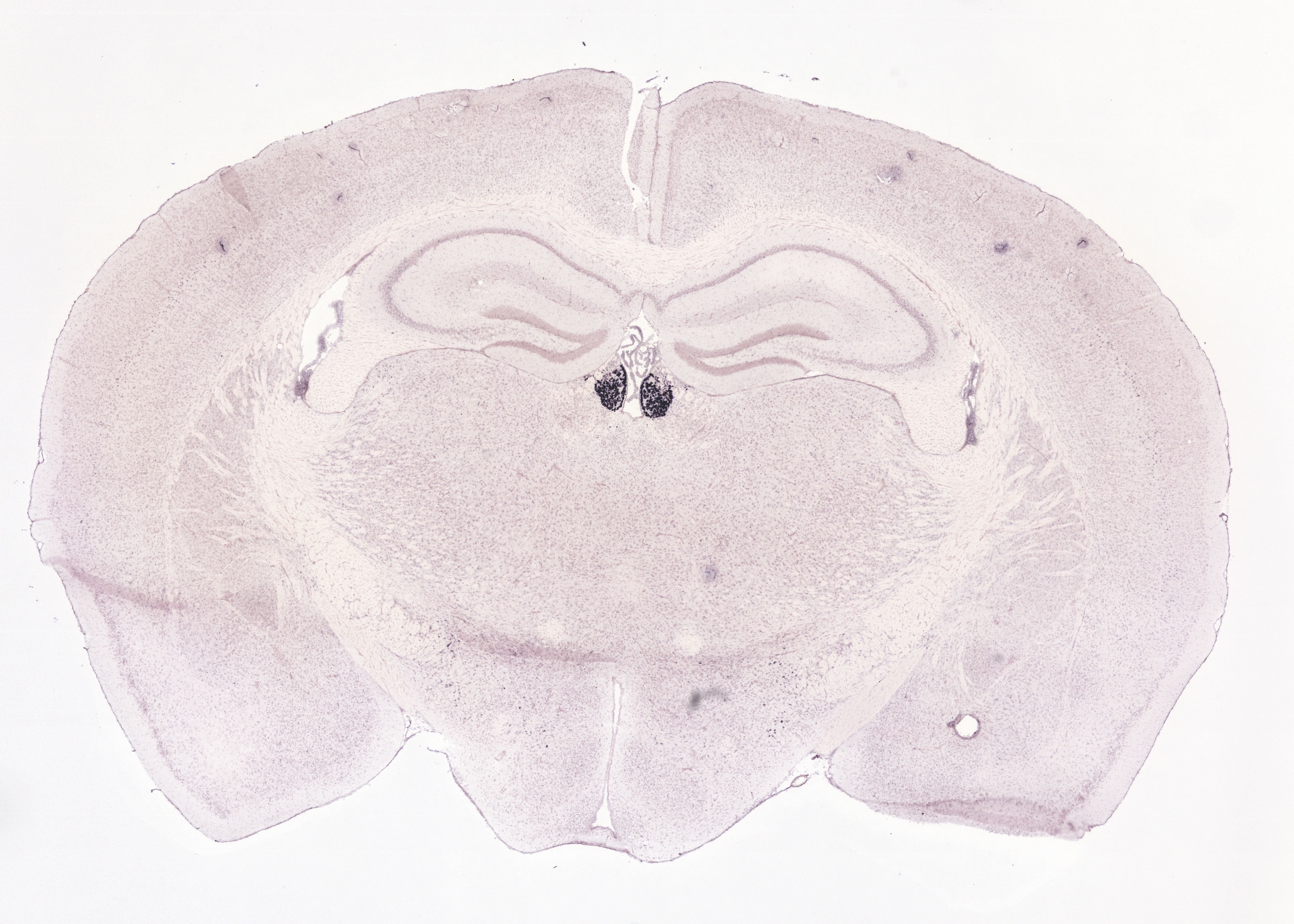 Allen ISH experiment 72119655, image 72040230 -- target region: MH (Medial habenula)