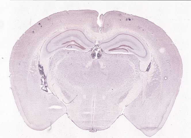 Allen ISH experiment 70436747, image 70289219 -- target region: MH (Medial habenula)