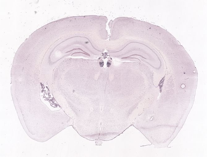 Allen ISH experiment 70436747, image 70289821 -- target region: MH (Medial habenula)