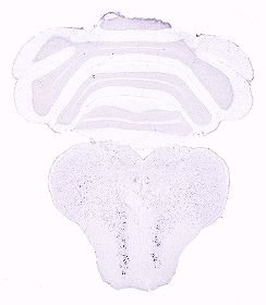 Allen ISH experiment 264, image 101940932 -- target region: MH (Medial habenula)