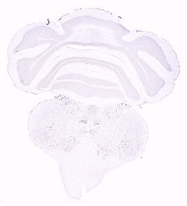 Allen ISH experiment 264, image 101940933 -- target region: MH (Medial habenula)