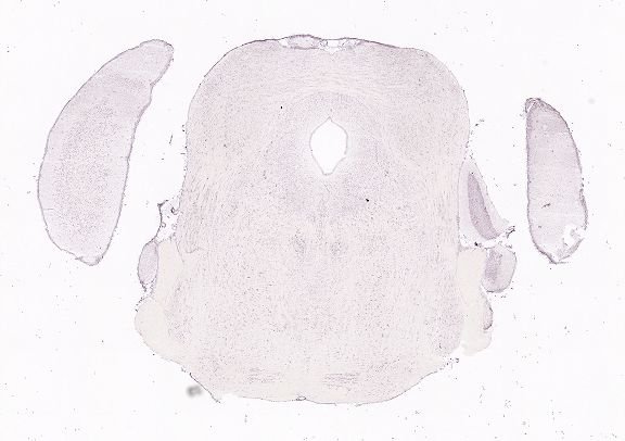 Allen ISH experiment 75888738, image 75724421 -- target region: SH (Septohippocampal nucleus)