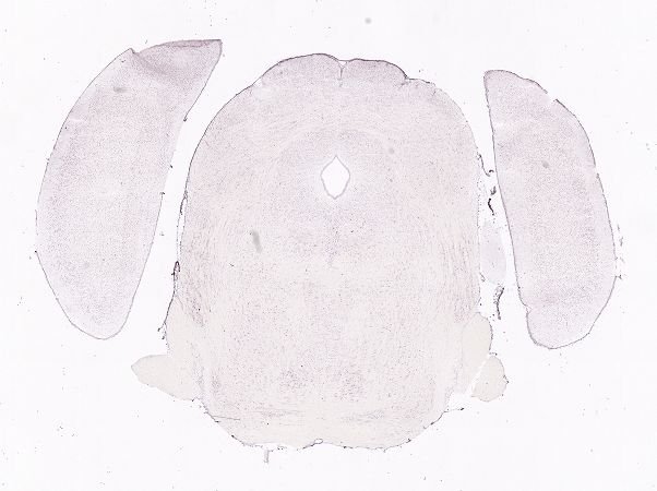 Allen ISH experiment 75888738, image 75724423 -- target region: SH (Septohippocampal nucleus)