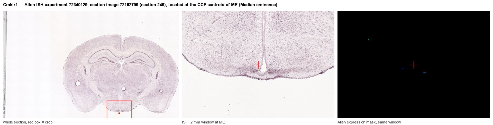 Cmklr1 Allen ISH at the CCF centroid of ME