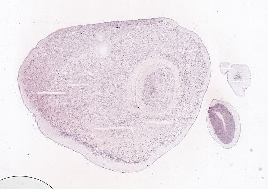 Allen ISH experiment 71380718, image 71084343 -- target region: IO (Inferior olivary complex)