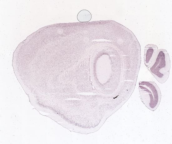 Allen ISH experiment 71380718, image 71084345 -- target region: IO (Inferior olivary complex)